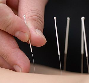 Acupuncturist.jpg